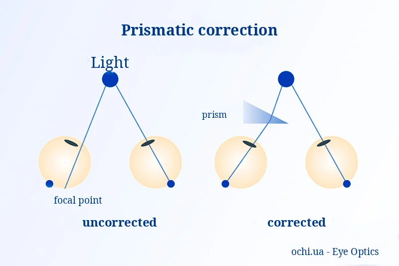 Binocular vision disorders and prismatic correction