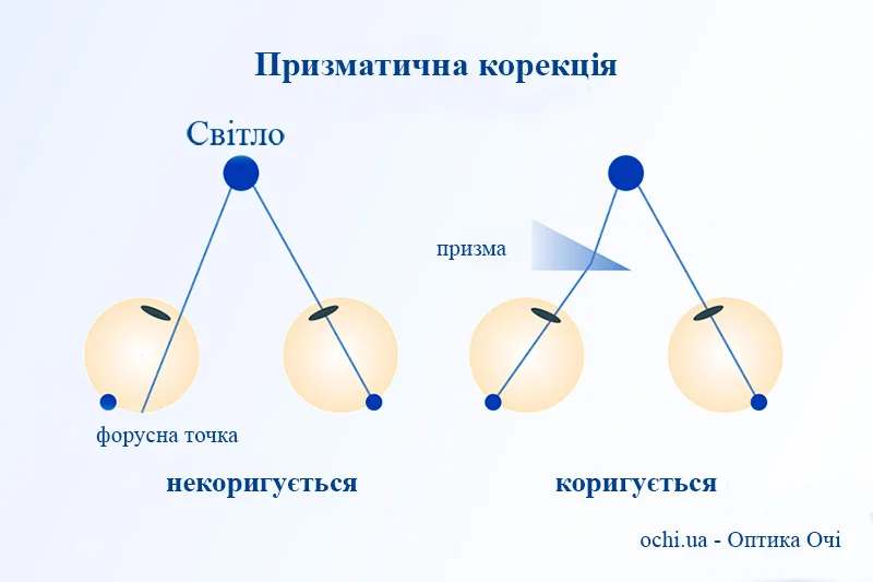 Порушення бінокулярногого зору та призматична корекція